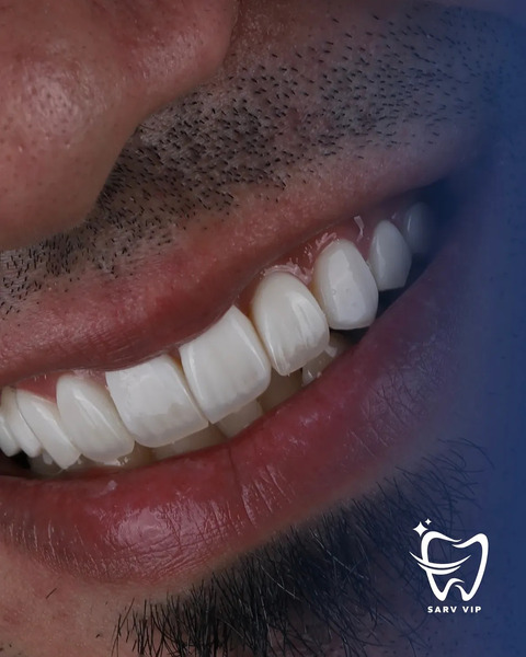 کامپوزیت مردانه
