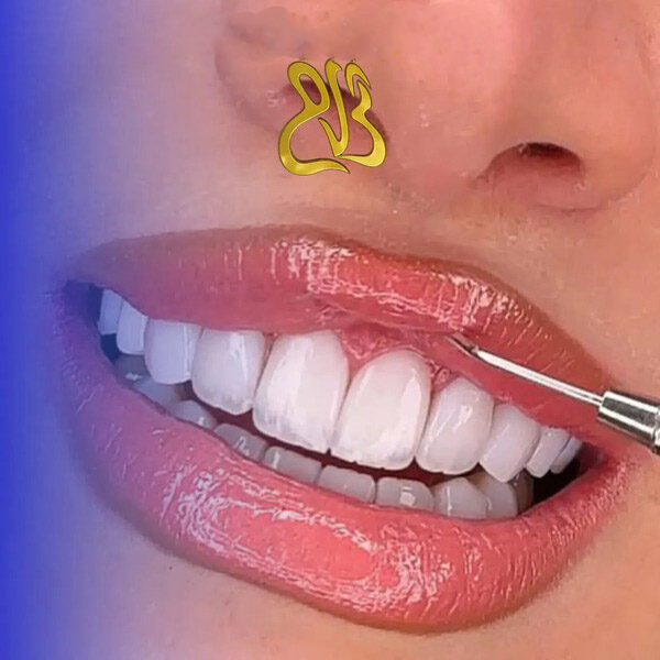 سفید یخی همان رنگ BL1 است؟