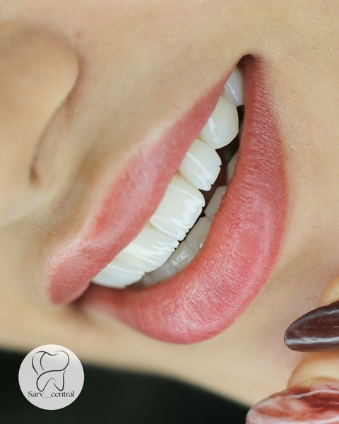 تغذیه بعد از کامپوزیت