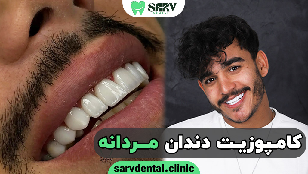 کامپوزیت دندان مردانه