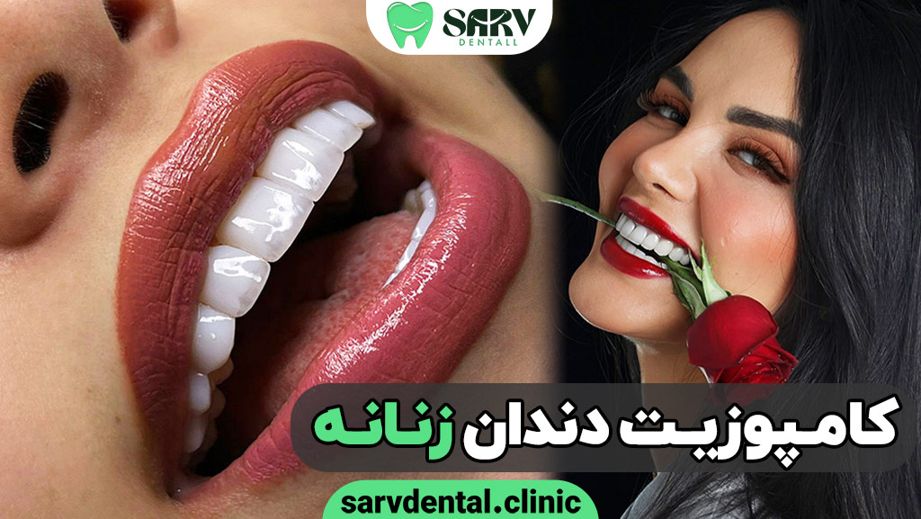کامپوزیت دندان زنانه