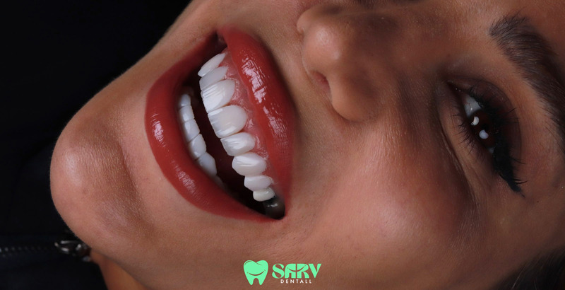 چگونه بهترین پکیج کامپوزیت را انتخاب کنیم؟